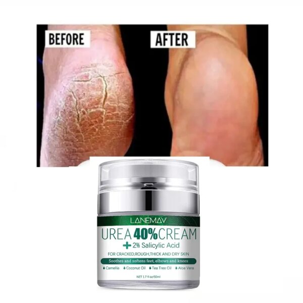Foot Care Cream for Cracked Heels Exfoliating Anti Crack Peeling Dead Skin Removal Foot Repair Whitening Urea Foot Cream